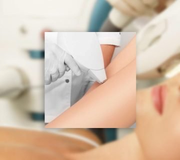 Laserska depilacija oz. trajna depilacija v Ljubljani. Kozmetični salon Spa Luna