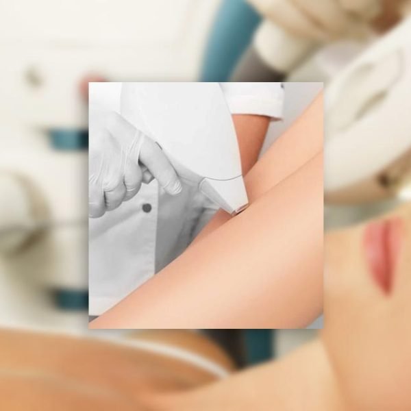 Laserska depilacija oz. trajna depilacija v Ljubljani. Kozmetični salon Spa Luna